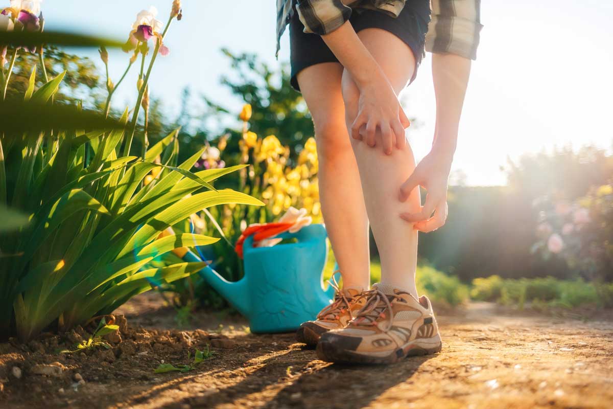 woman scratching a bug bite
